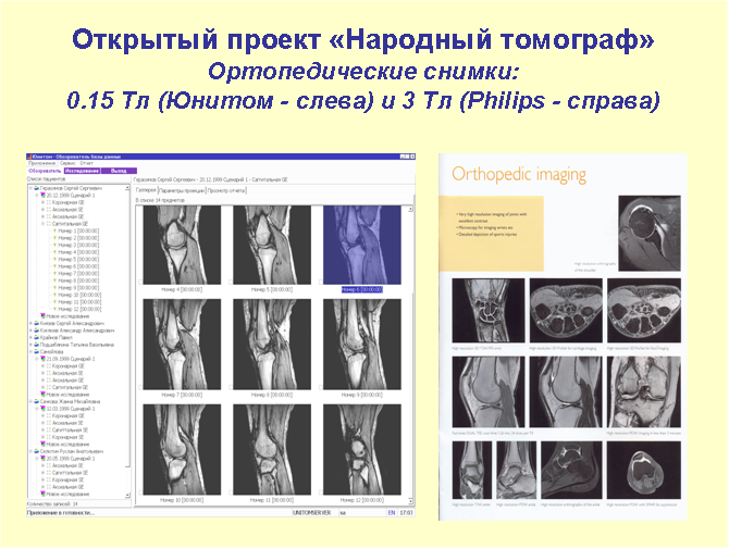 tomograph philips tomograph unitom